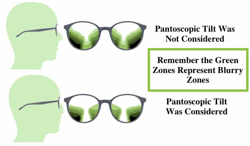The picture shows  clear and blurry zones in Progressive Lens Designs when pantoscopic tilt was considered or not. 