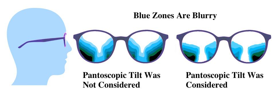 The picture shows blurry zones in progressive lenses if the pantoscopic tilt was considered or not.