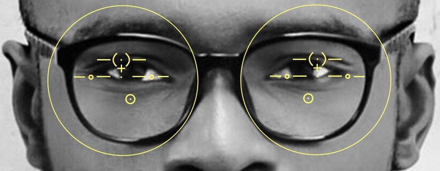 The picture shows progressive glasses with a pupillary distance setting which is too wide for the wearer behind the lenses.