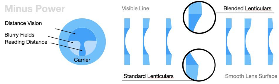 The picture shows different lenticular lens designs for myopes
