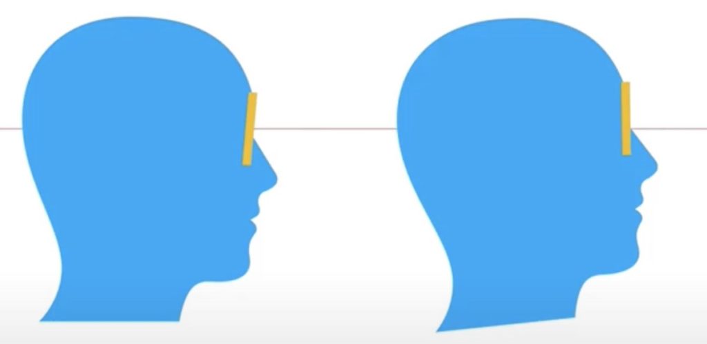 The picture shows a head from the side and how the different passions lead to a altered position of the progressive lenses in the frame