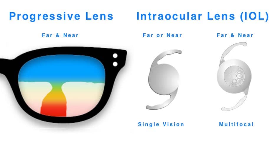 The picture shows a progressive lens and two intraocular lenses for cataract surgery